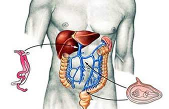 Peretz Capelhuchnik - Foto 1