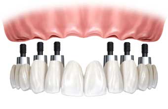 Laboratório Prótese Dentária Luiz Kiyan - Foto 1