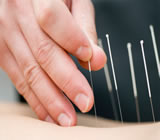 Acupuntura no Jardim Europa