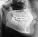 Radiologia Odontológica no Jardim Europa